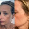 Advanced Brightening Kit - Image 5